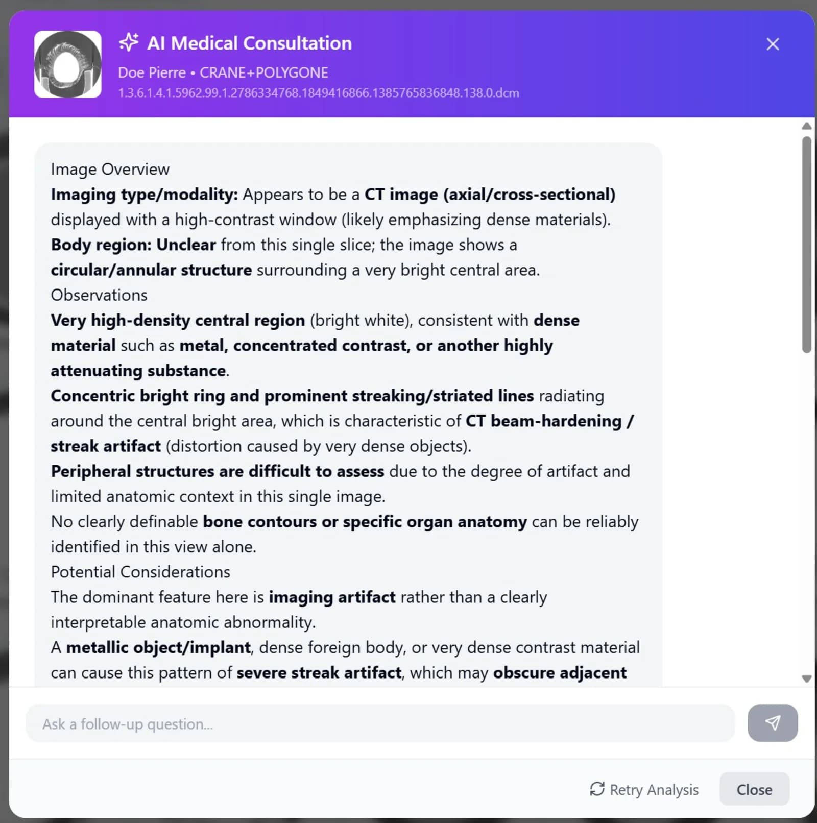 AI Consultation Panel with Severity Badge and Structured Findings