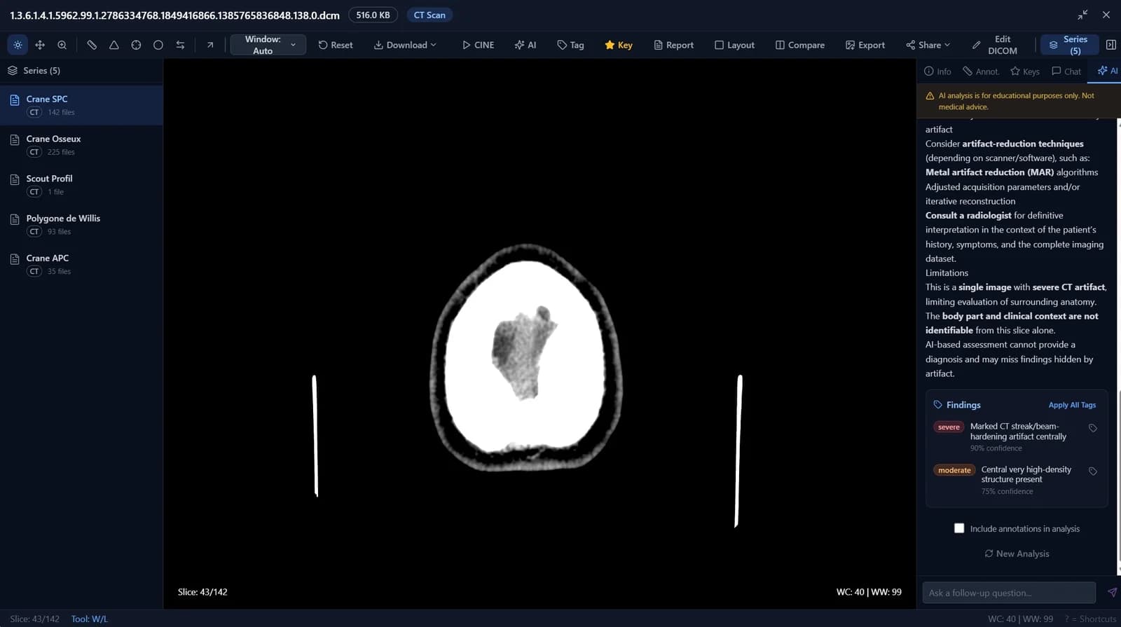 AI Consultation Panel with Severity Badge and Medical Image Analysis