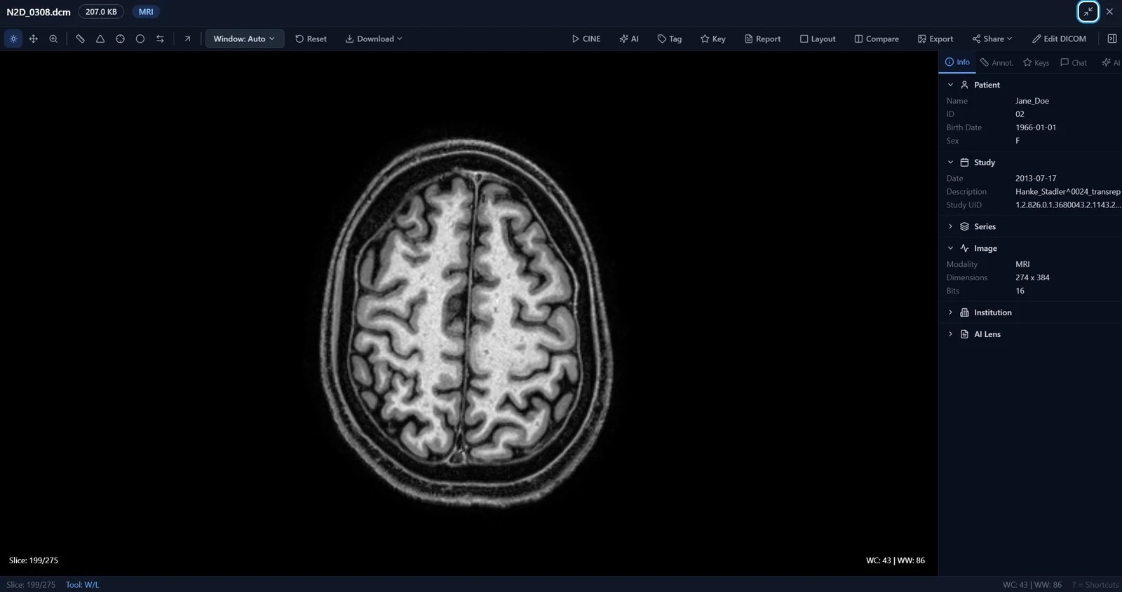AI Lens Medical — DICOM viewer inside BigMind Resilience
