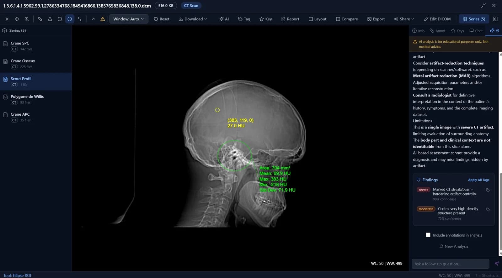 DICOM Viewer with window presets toolbar and measurement tools