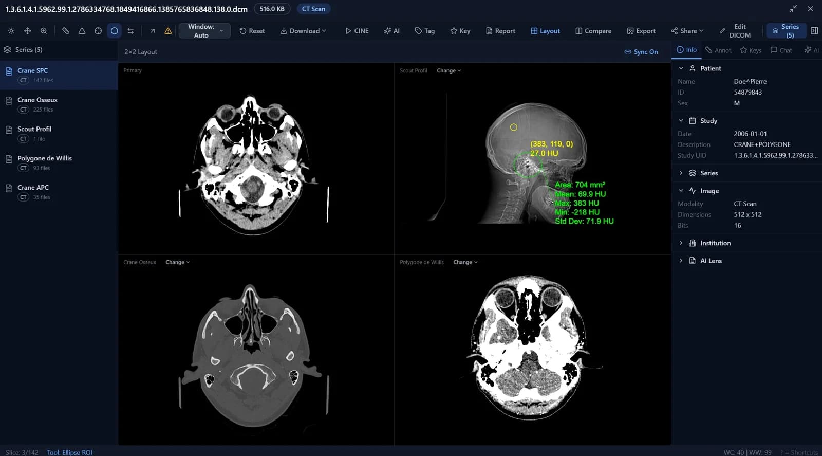 2x2 Multi-Viewport Layout showing four series from the same study