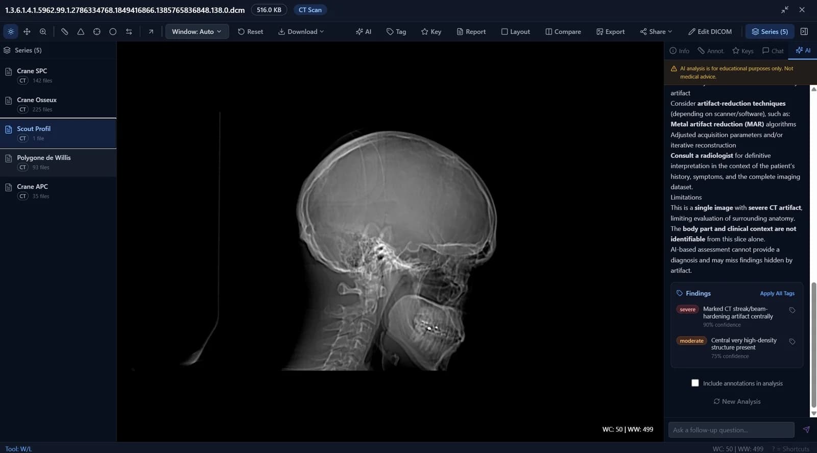 DICOM Viewer - Full interface with toolbar, window presets, and viewport controls
